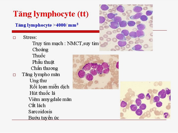 Tăng lymphocyte (tt) Tăng lymphocyte >4000/ mm 3 o o Stress: Trụy tim mạch