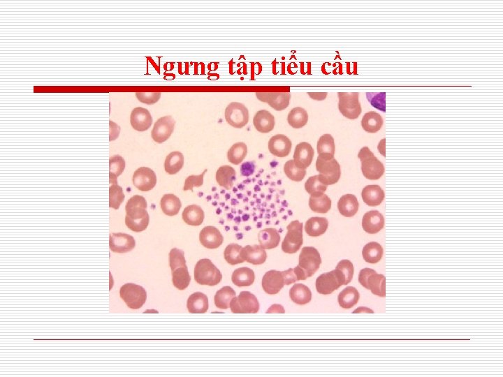 Ngưng tập tiểu cầu 