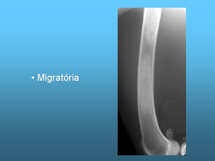  • Migratória 