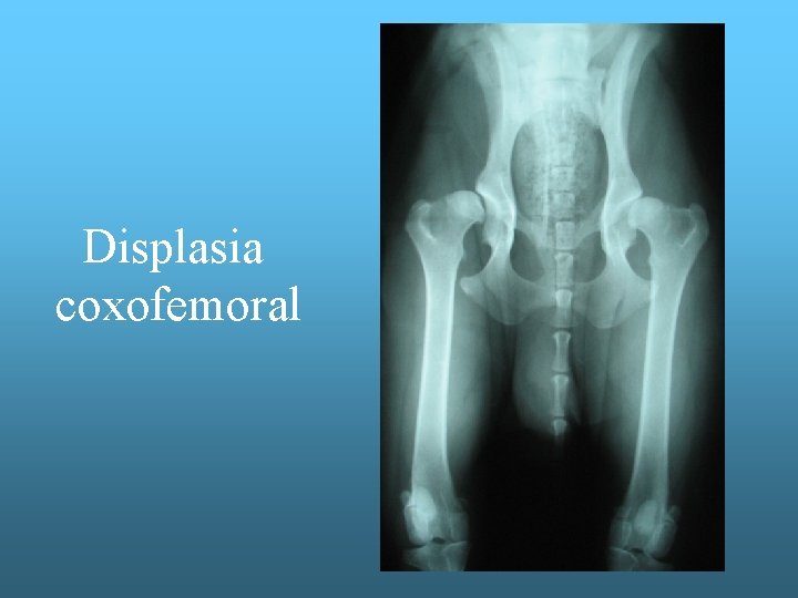 Displasia coxofemoral 