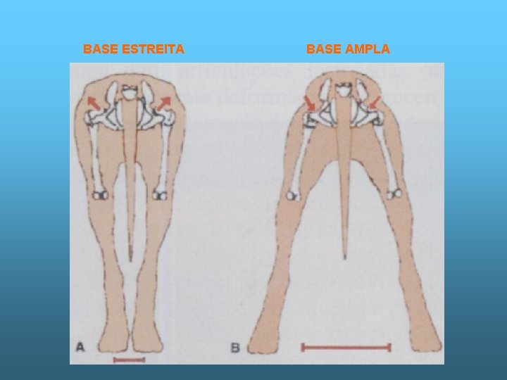 BASE ESTREITA BASE AMPLA 