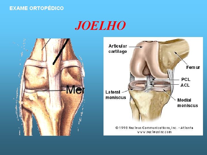 EXAME ORTOPÉDICO JOELHO 