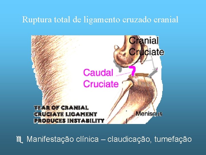 Ruptura total de ligamento cruzado cranial Manifestação clínica – claudicação, tumefação 