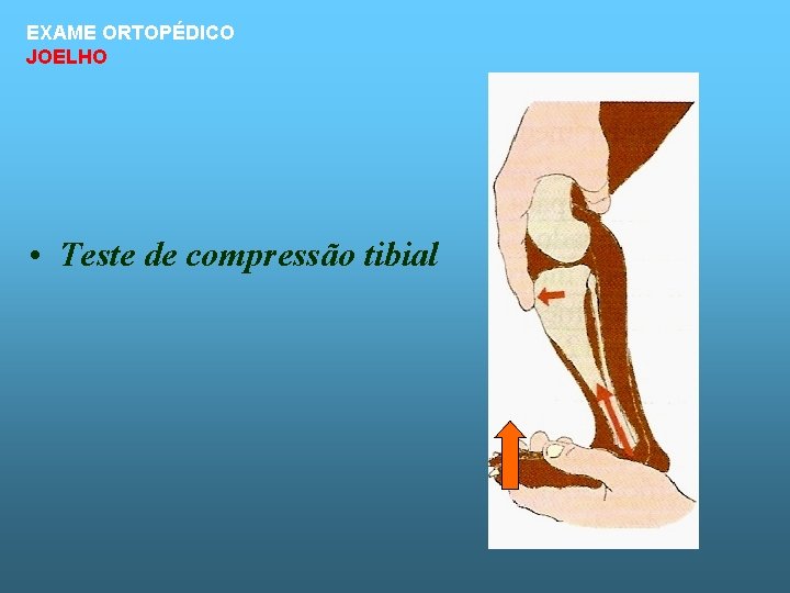 EXAME ORTOPÉDICO JOELHO • Teste de compressão tibial 