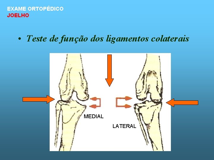 EXAME ORTOPÉDICO JOELHO • Teste de função dos ligamentos colaterais MEDIAL LATERAL 