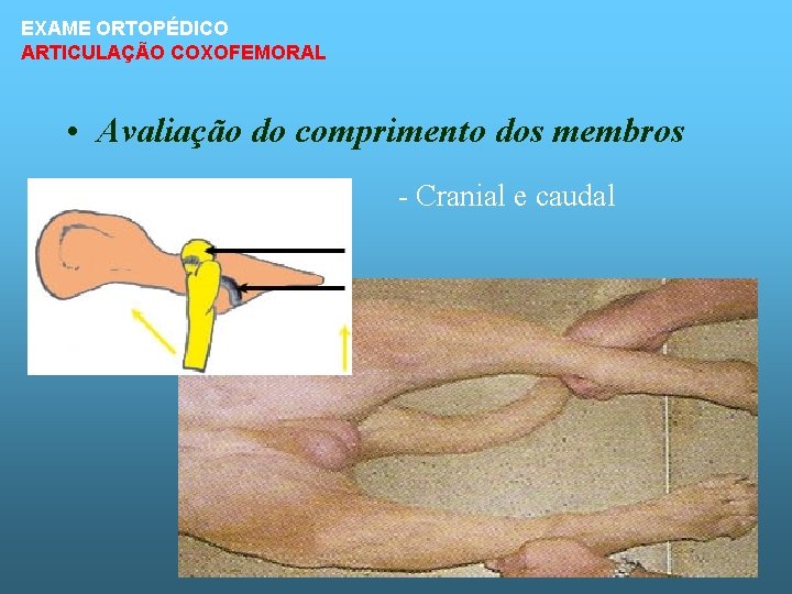 EXAME ORTOPÉDICO ARTICULAÇÃO COXOFEMORAL • Avaliação do comprimento dos membros - Cranial e caudal