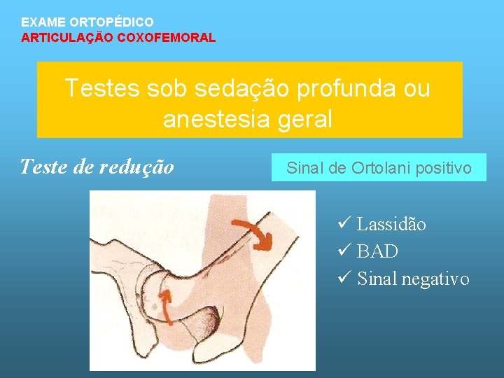 EXAME ORTOPÉDICO ARTICULAÇÃO COXOFEMORAL Testes sob sedação profunda ou anestesia geral Teste de redução