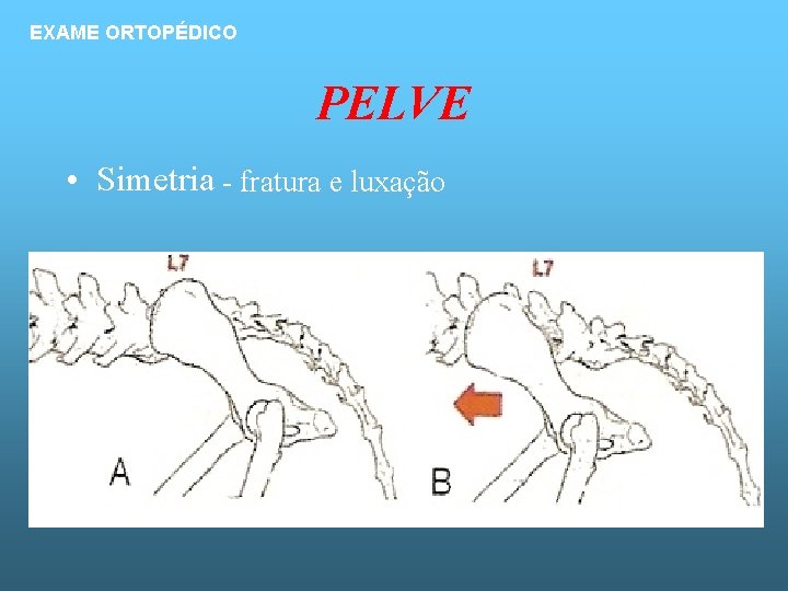 EXAME ORTOPÉDICO PELVE • Simetria - fratura e luxação 