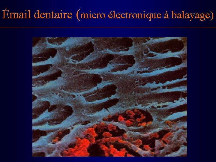 Émail dentaire (micro électronique à balayage) 