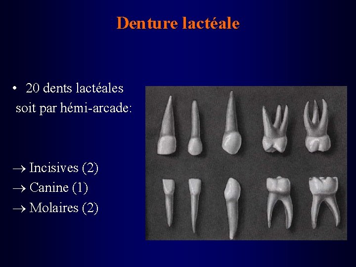 Denture lactéale • 20 dents lactéales soit par hémi-arcade: Incisives (2) Canine (1) Molaires