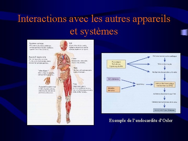 Interactions avec les autres appareils et systèmes Exemple de l’endocardite d’Osler 