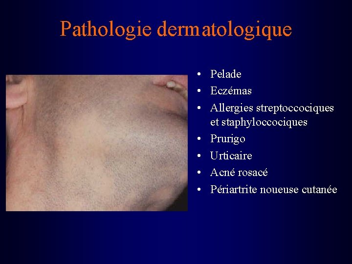 Pathologie dermatologique • Pelade • Eczémas • Allergies streptoccociques et staphyloccociques • Prurigo •