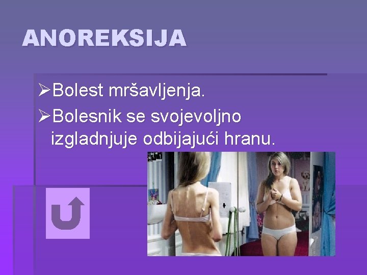 ANOREKSIJA ØBolest mršavljenja. ØBolesnik se svojevoljno izgladnjuje odbijajući hranu. 