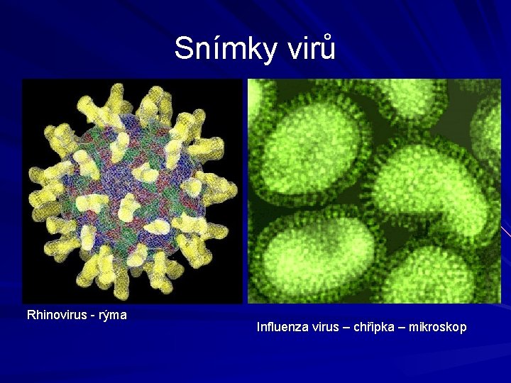 Snímky virů Rhinovirus - rýma Influenza virus – chřipka – mikroskop 