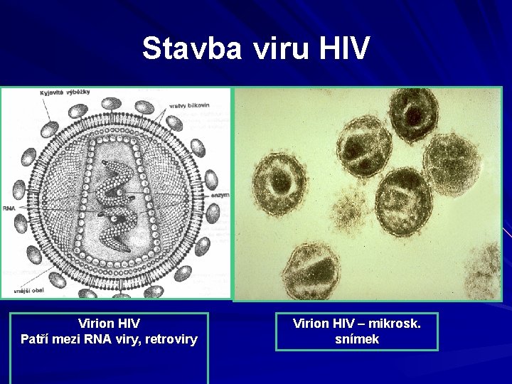 Stavba viru HIV Virion HIV Patří mezi RNA viry, retroviry Virion HIV – mikrosk.