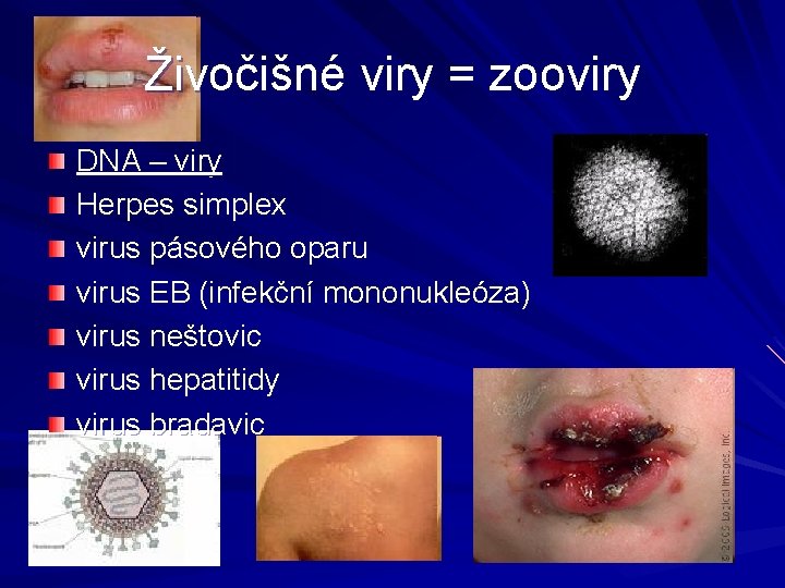 Živočišné viry = zooviry DNA – viry Herpes simplex virus pásového oparu virus EB