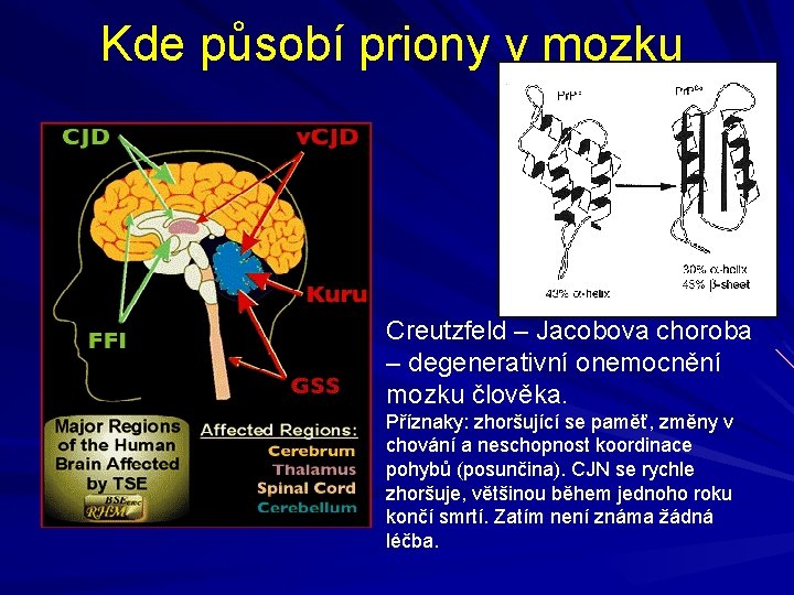 Kde působí priony v mozku Creutzfeld – Jacobova choroba – degenerativní onemocnění mozku člověka.