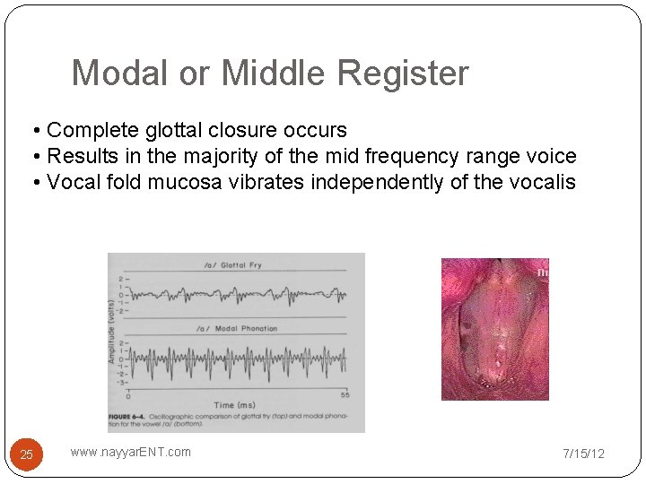 Modal or Middle Register • Complete glottal closure occurs • Results in the majority