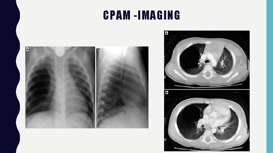 CPAM -IMAGING 