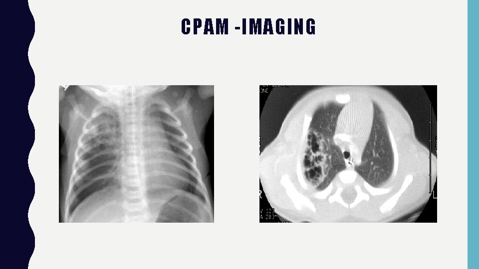 CPAM -IMAGING 