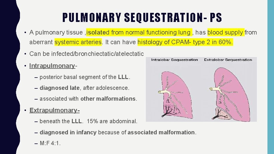 PULMONARY SEQUESTRATION- PS • A pulmonary tissue , isolated from normal functioning lung ,