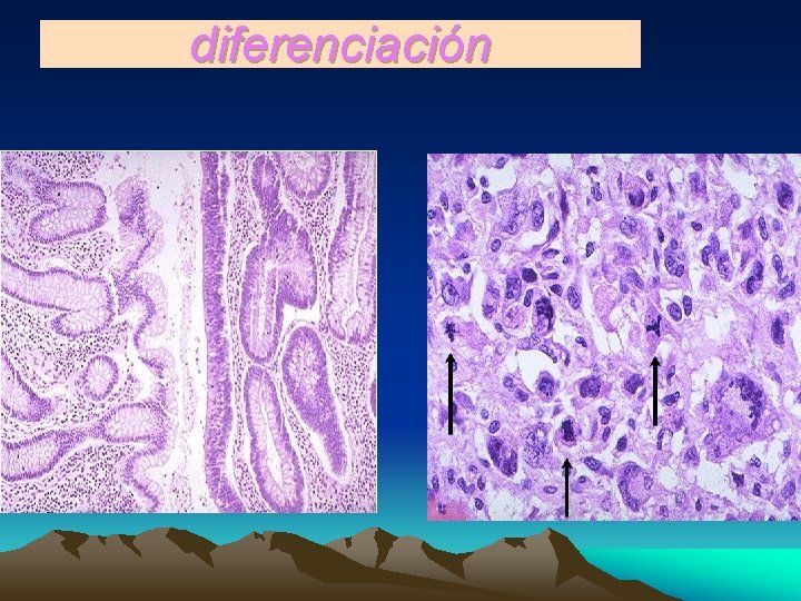 diferenciación 