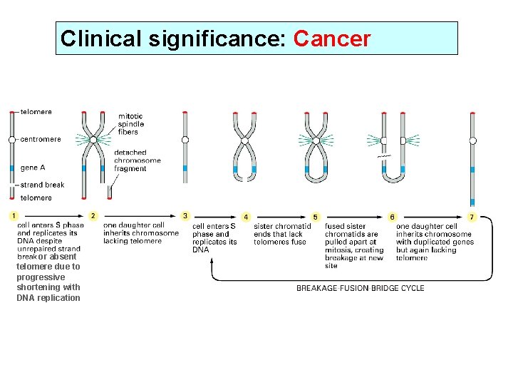 Clinical significance: Cancer or absent telomere due to progressive shortening with DNA replication 