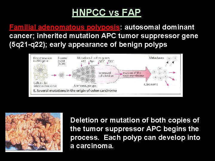 HNPCC vs FAP Familial adenomatous polyposis: autosomal dominant cancer; inherited mutation APC tumor suppressor