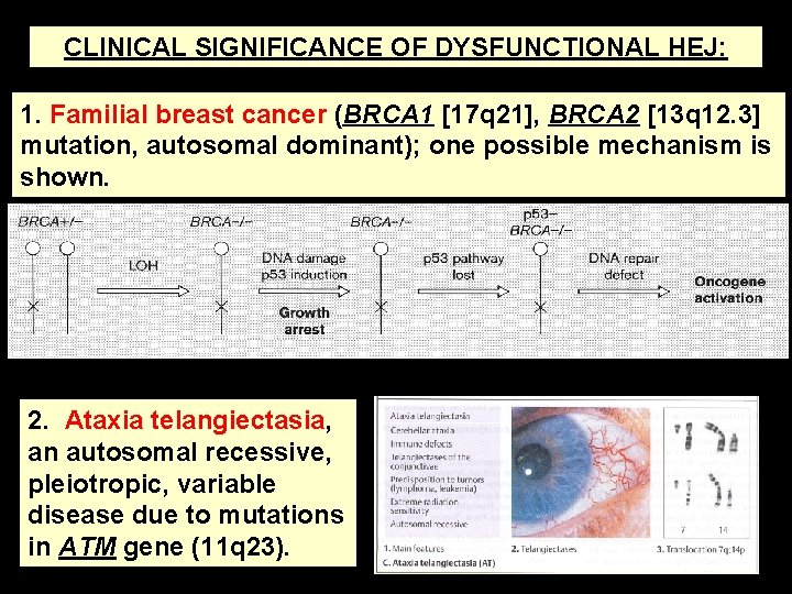 CLINICAL SIGNIFICANCE OF DYSFUNCTIONAL HEJ: 1. Familial breast cancer (BRCA 1 [17 q 21],