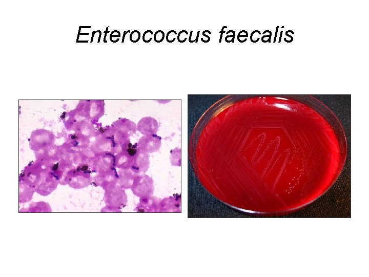 Enterococcus faecalis 