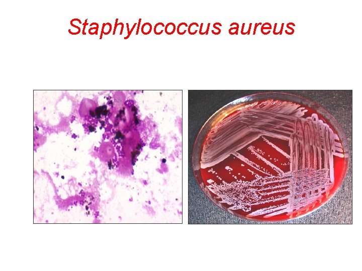 Staphylococcus aureus 