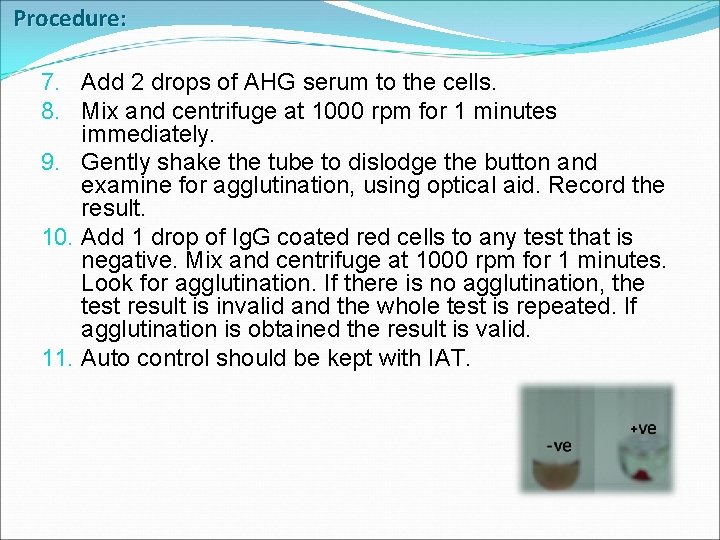 Procedure: 7. Add 2 drops of AHG serum to the cells. 8. Mix and