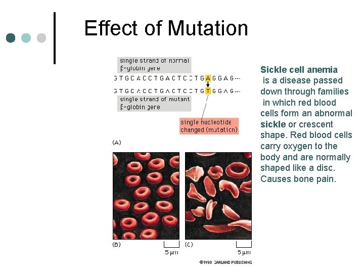 Effect of Mutation Sickle cell anemia is a disease passed down through families in