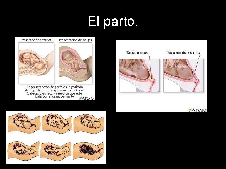 El parto. 