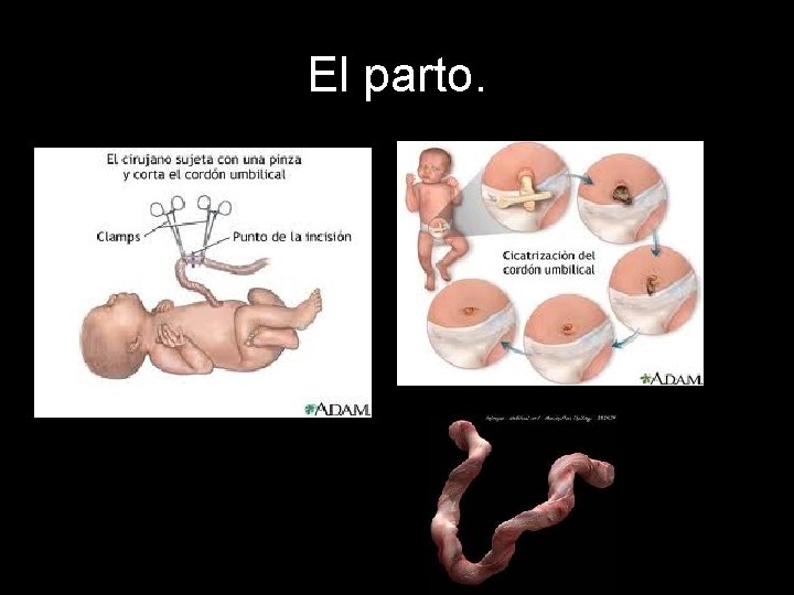 El parto. 