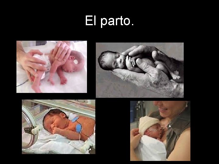 El parto. 