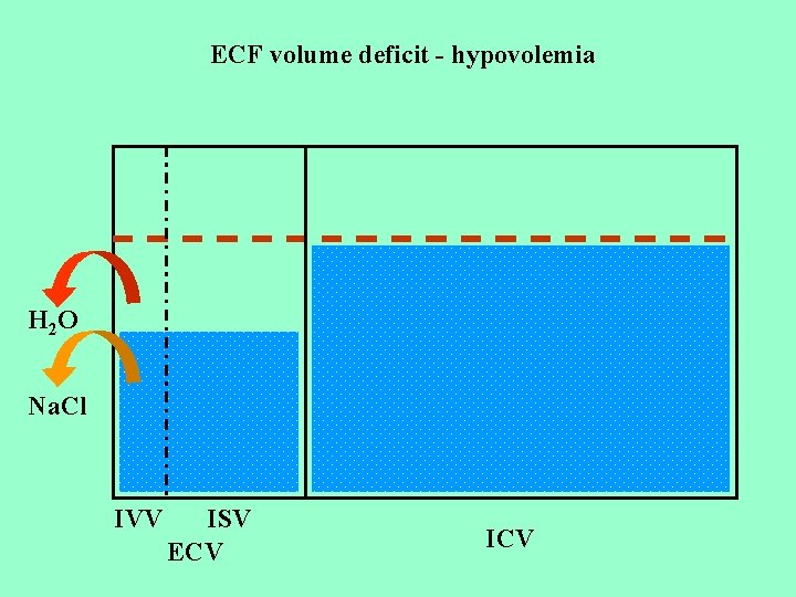 ECF volume deficit - hypovolemia H 2 O Na. Cl IVV ISV ECV ICV