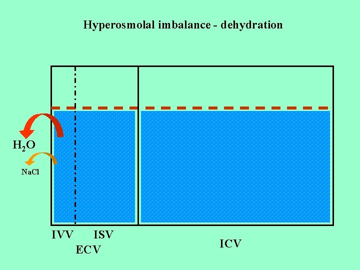 Hyperosmolal imbalance - dehydration H 2 O Na. Cl IVV ISV ECV ICV 