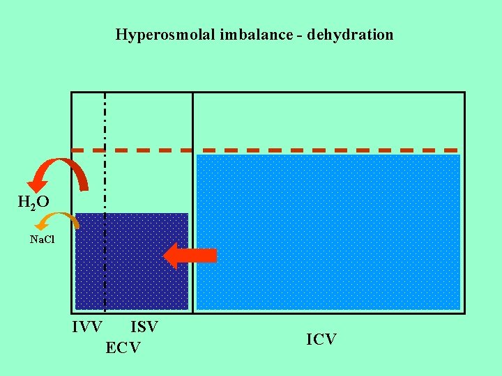 Hyperosmolal imbalance - dehydration H 2 O Na. Cl IVV ISV ECV ICV 