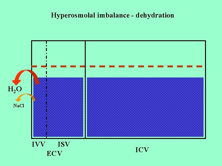 Hyperosmolal imbalance - dehydration H 2 O Na. Cl IVV ISV ECV ICV 
