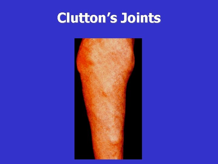 Clutton’s Joints 