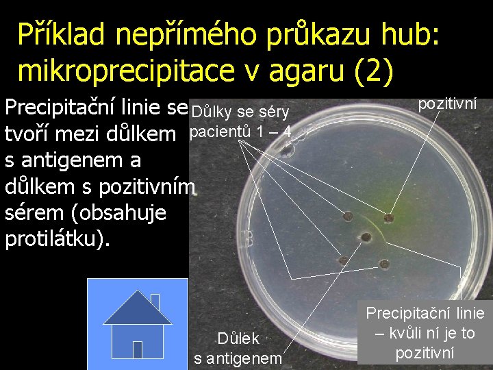 Příklad nepřímého průkazu hub: mikroprecipitace v agaru (2) Precipitační linie se Důlky se séry