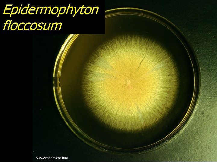 Epidermophyton floccosum www. medmicro. info 