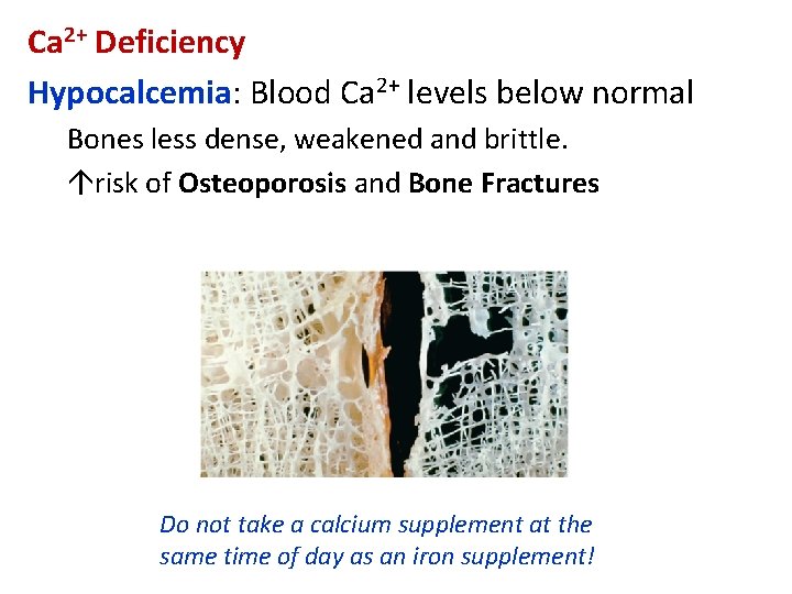 Ca 2+ Deficiency Hypocalcemia: Blood Ca 2+ levels below normal Bones less dense, weakened
