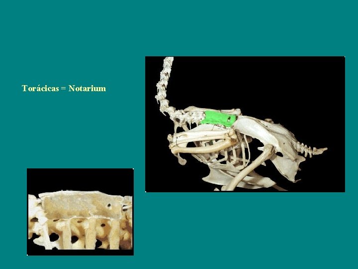 Torácicas = Notarium 