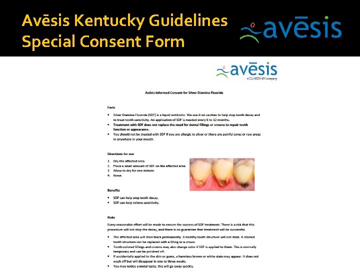 Avēsis Kentucky Guidelines Special Consent Form 