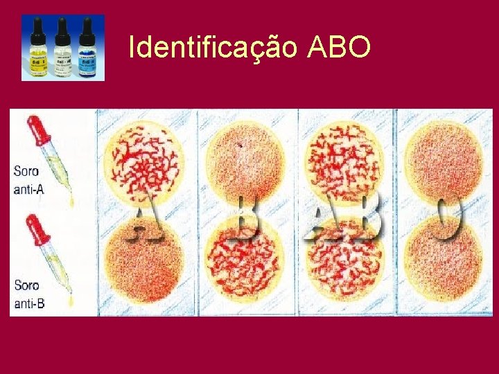 Identificação ABO 