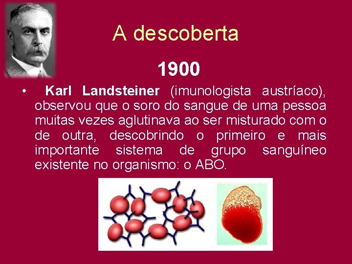 A descoberta 1900 • Karl Landsteiner (imunologista austríaco), observou que o soro do sangue