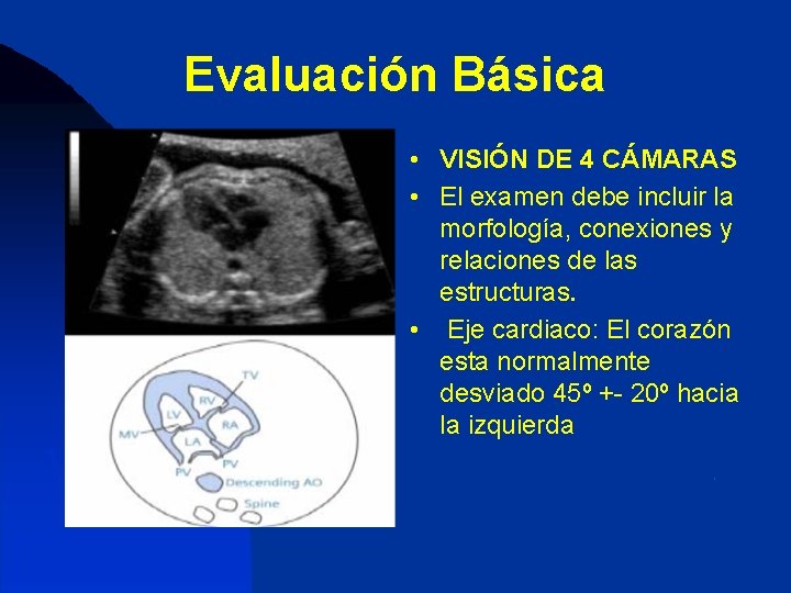 Evaluación Básica • VISIÓN DE 4 CÁMARAS • El examen debe incluir la morfología,