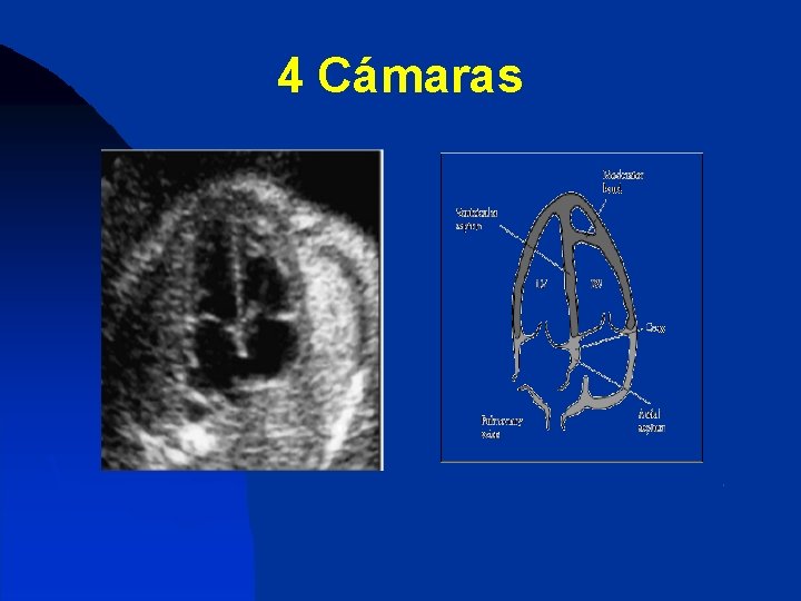 4 Cámaras 